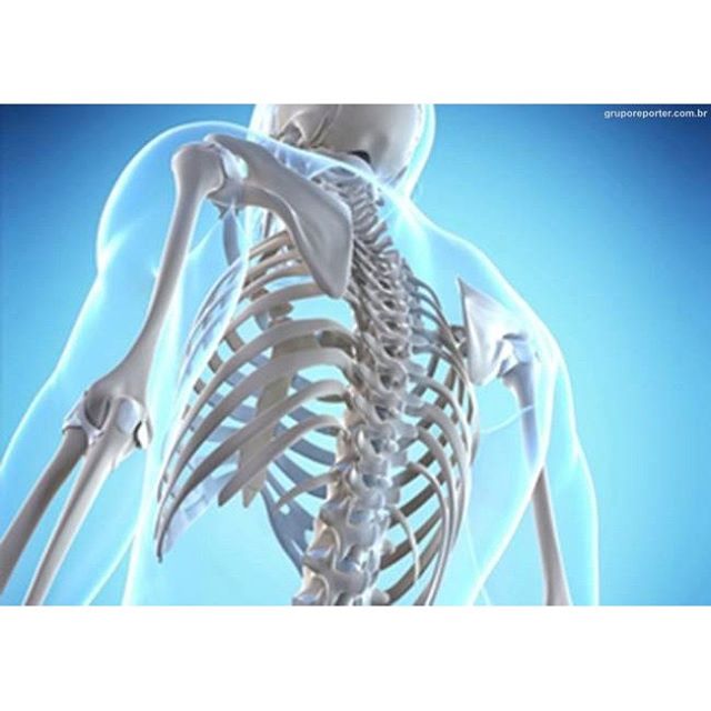 OSTEOPOROSE E LEITE
Este sempre é um tema recorrente no consultório, principalmente quando tenho que retirar laticínios do plano alimentar de algum paciente. A pergunta sempre é: E o cálcio? Como fica? E o risco de osteoporose? Os laticínios são fontes de cálcio sim, mas são também fonte de proteínas e carboidratos que podem machucar a mucosa do intestino, causando sensibilidade em muitas pessoas. Alguns sintomas são: diarreia, flatulência, enxaquecas, sinusite, rinite, dermatite. Além disso, o cálcio dos laticínios não tem uma biodisponilidade tão grande, ou seja a absorção do cálcio dos laticinios é menos eficiente que ,por exemplo, outras ótimas fontes como a couve, o brócolis, o espinafre cozido e o tofu. 
Para garantir uma boa densidade dos ossos é necessário cálcio, mas também magnésio, silício boro, lisina, vitamina D e uma alimentação alcalina. De nada adianta ingerir muito cálcio se faltar outros nutrientes ou se alimentação causar acidez no sangue. Uma alimentação rica em sal de cozinha, fritura, refrigerantes, carne vermelha, industrializados, laticínios, açúcar, farinha branca gera uma acidez grande que o corpo compensa retirando cálcio e magnésio do osso. 
Portanto, para proteger seus ossos capriche nas outras fontes citadas acima, alcalinize sua dieta eliminando os alimentos que acidificam e acrescentando (carnes brancas, sal marinho, agua com limão, algas marinhas, lima). Pratique exercícios físicos e tome sol.